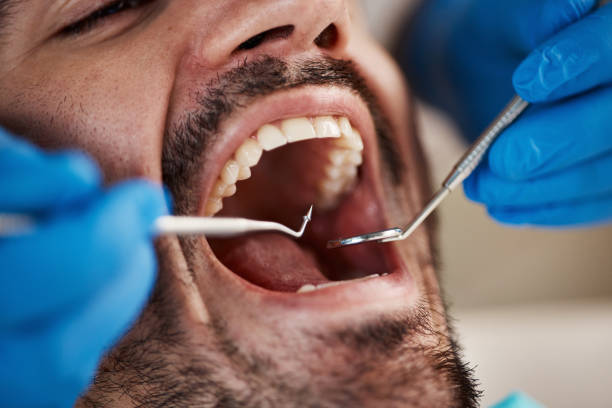 Best Dental Abscess Treatment in Pecan Grove, TX